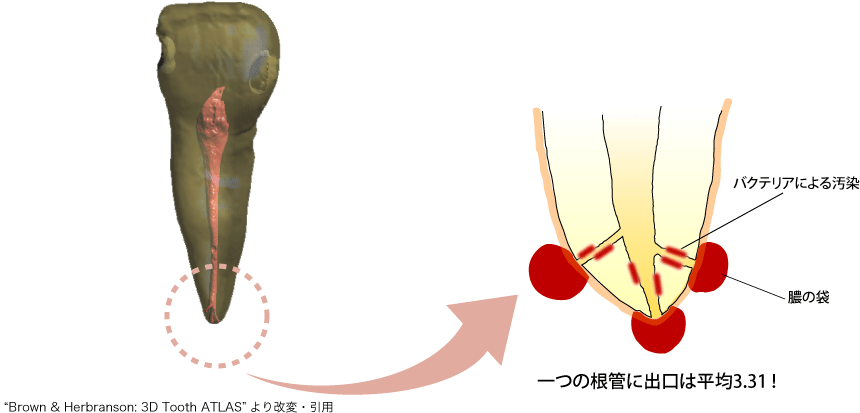 根尖 拡大図