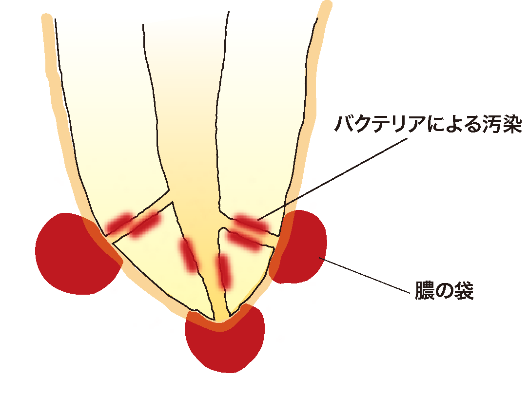 根管の構造